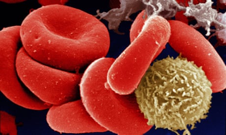 Blood-thinning drugs 'can reduce risk of dementia by up to 48%'