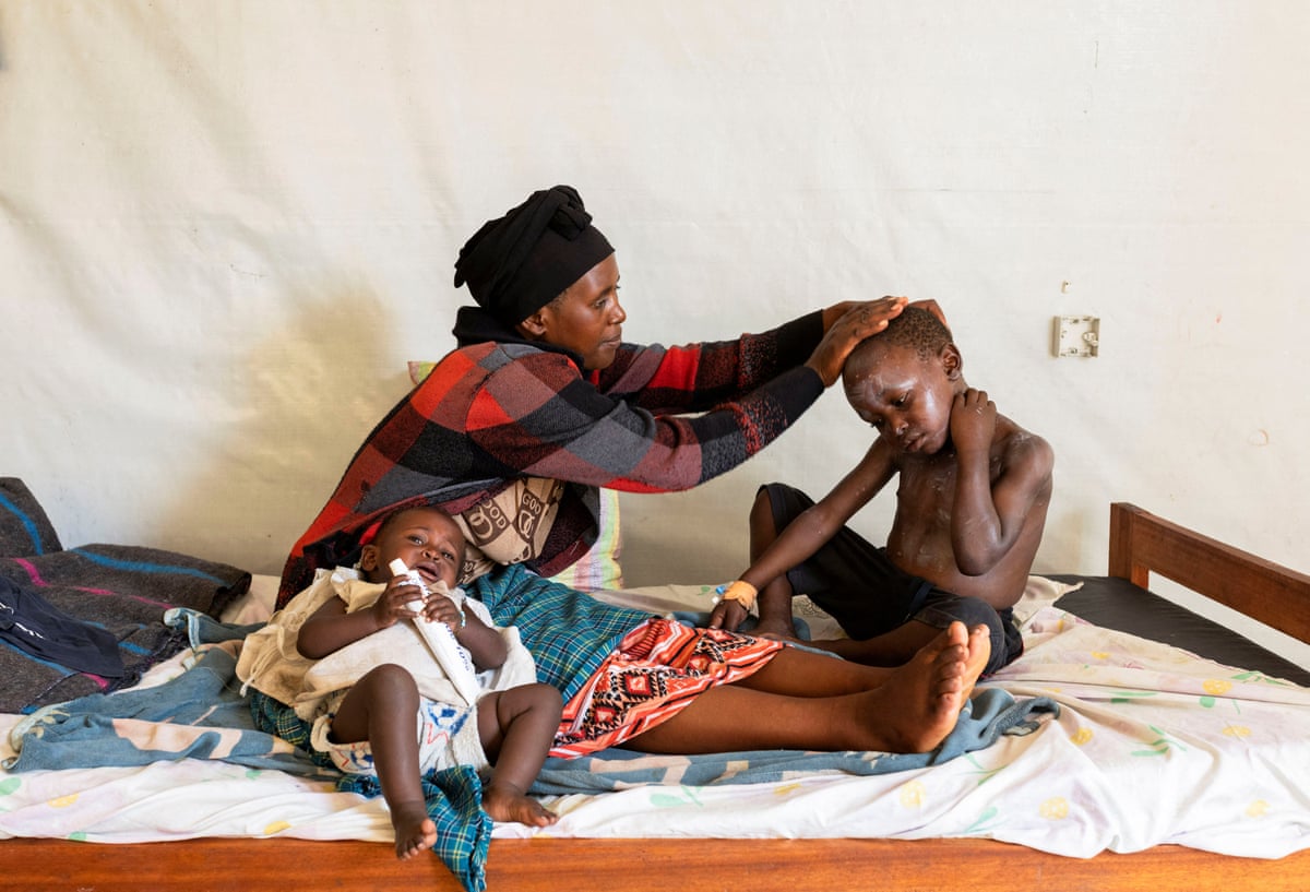 An African woman applies medication to the skin of a child