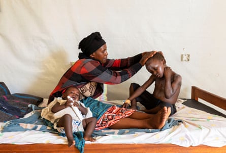 An African woman applies medication to the skin of a child