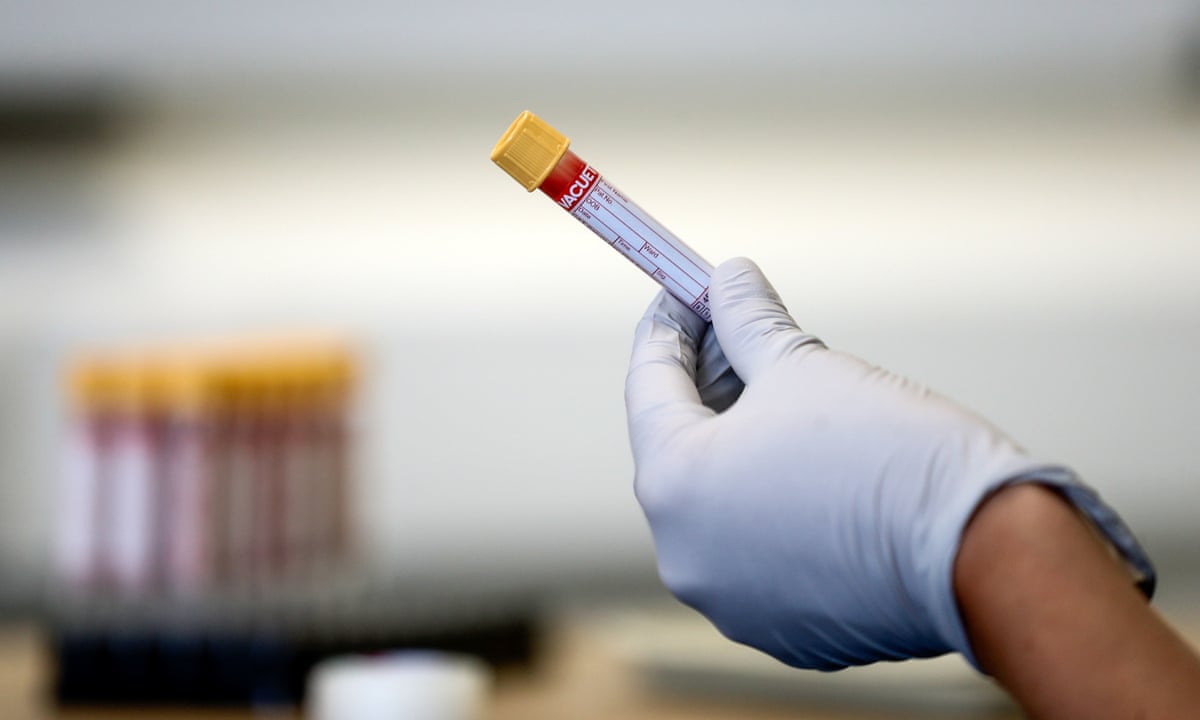 Blood test could revolutionise diagnosis of Alzheimer's, experts say |  Alzheimer's | The Guardian