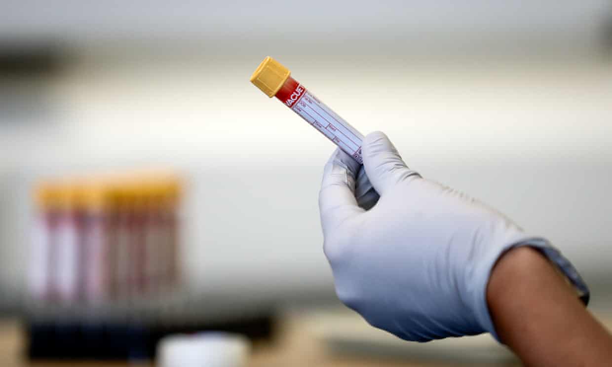 Blood test could revolutionise diagnosis of Alzheimer’s, experts say (theguardian.com)