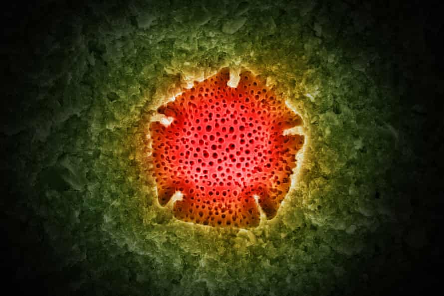 Imagen de microscopio electrónico de un pentagrama de polen