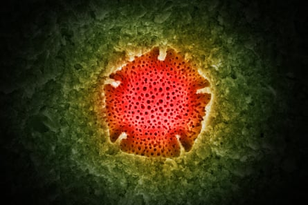 An electron microscopy image of a single pentagonal pollen grain