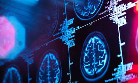 neuroscience research studies Human brain scan in a neurology clinic