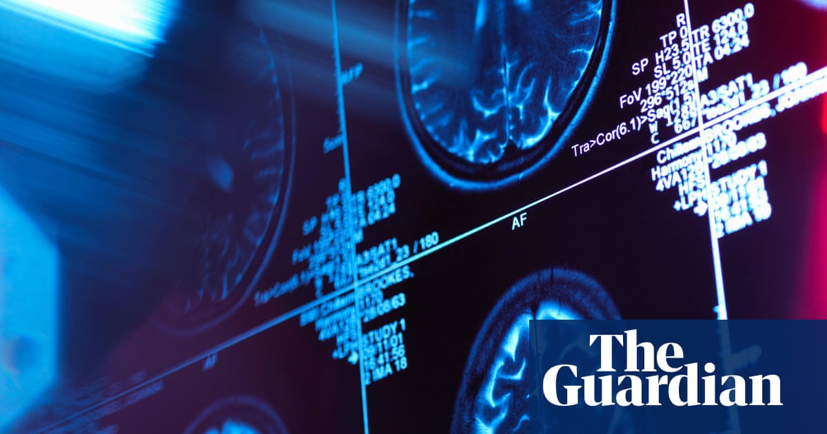 On dementia, we need to tell it how it is | Letter