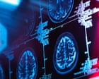 On dementia, we need to tell it how it is