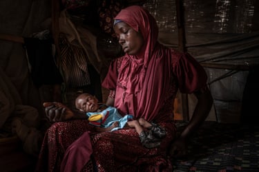 Bashirya Murtala, 20, holds Rahila, 2 months, who appears alarmingly underweight