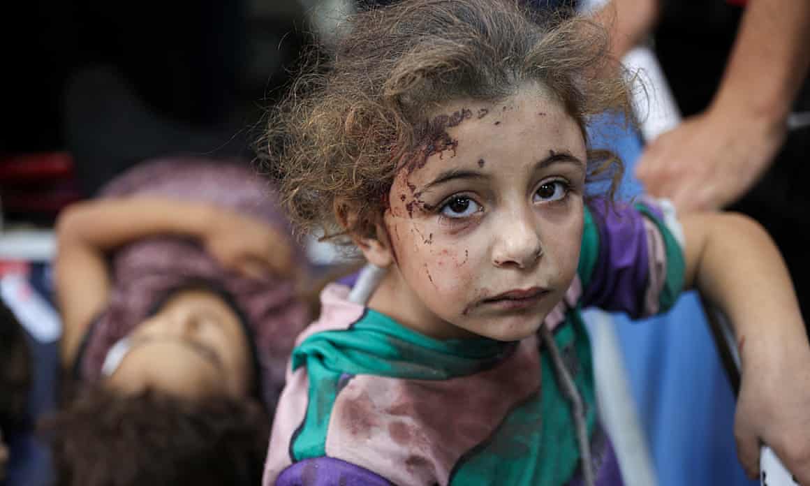 Injured childrenaza, 21 October 2024.