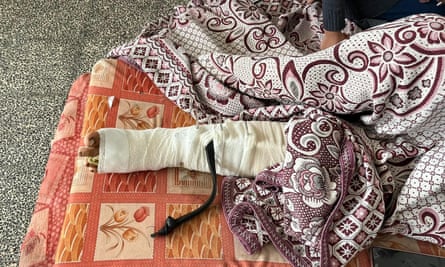 إصابة في ساق مها. وقالت: