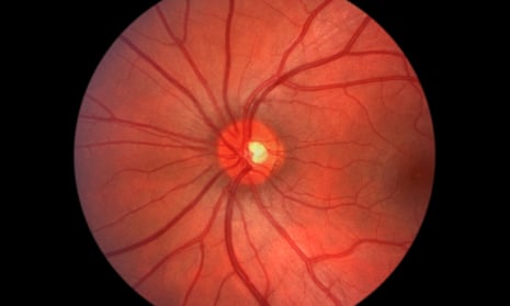 Retinal scans are produced rapidly, but require great skill to interpret.