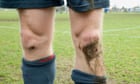 Why is it so tempting to pick a scab?