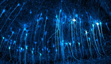 Neurons in an expanded mouse brain