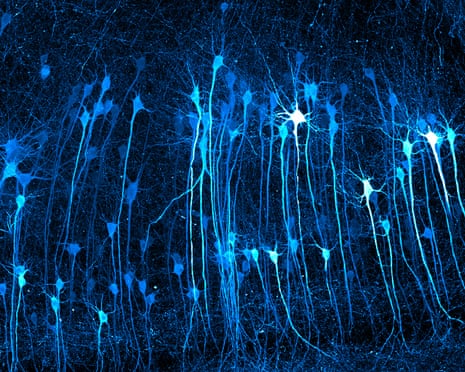 Neurons in an expanded mouse brain