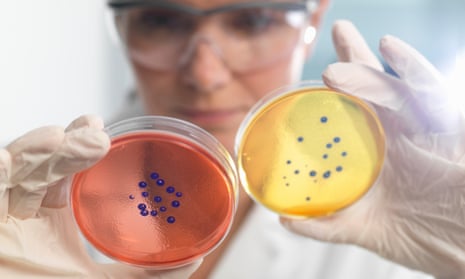 Scientist examining set of petri dishes in microbiology