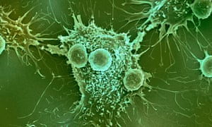 T-lymfocyten en kankercellen. 