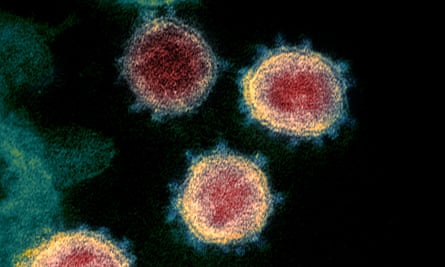 An electron microscope image of the virus that causes Covid-19.