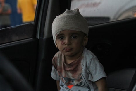 Wounded Palestinians, injured following Israeli air raids, visit Al-Shifa Hospital for treatment in Gaza City.