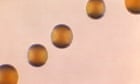 Bacteria that cause meningitis on the rise, CDC warns