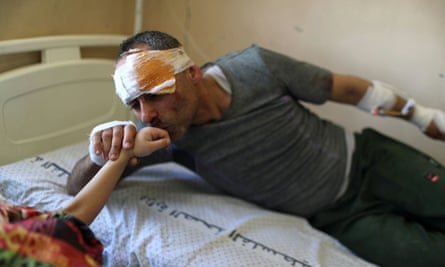 Bandaged patient kisses daughter's hand