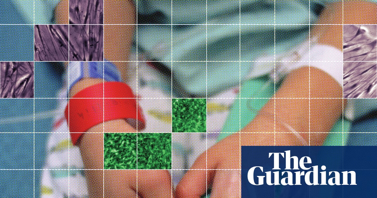 Autistic children injected with unapproved stem cell treatments supported by RFK Jr Autistic children injected with unapproved stem cell treatments supported by RFK Jr