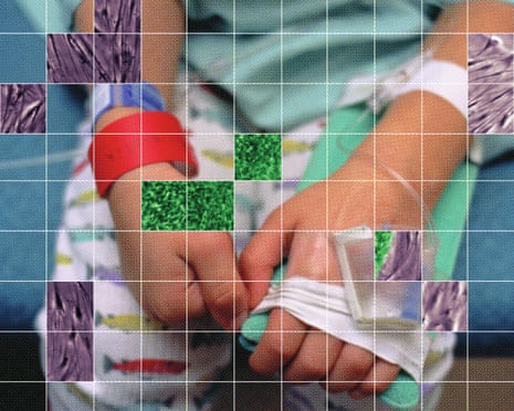 Child in hospital gown touches fingers together