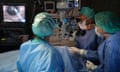 Three surgeons in an operating theatre looking at an image of an eye on a screen