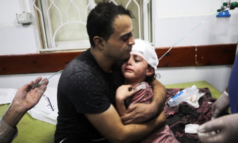 A Palestinian man holds his injured daughter at the Najjar hospital following an Israeli air strike on a home in Rafah, in the southern Gaza Strip, on Monday, 30 October 2023.
