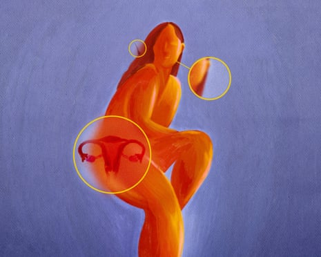 A painted figure in orange sits with circles highlighting the ovaries, face and hair