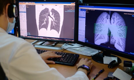 A man looking at two screens with CT scans of a person's lungs.