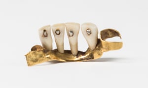 Swagged gold partial denture with human teeth, c1800