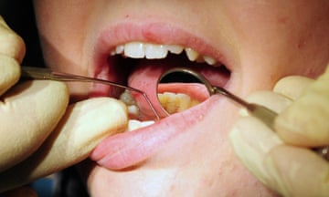 A dentist inspects a patient's teeth