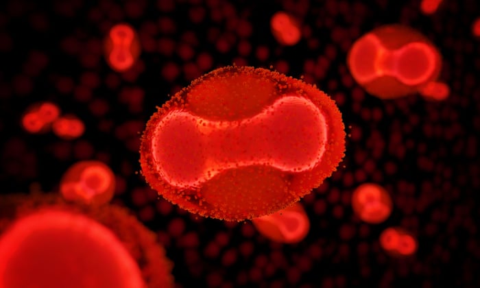 The monkeypox virus under a microscope.