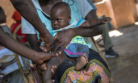A baby from the village of Tomali, Malawi, is injected with a vaccine against malaria.