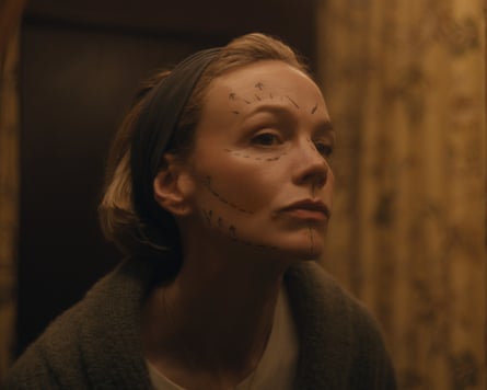Carey Mulligan with lines drawn on her face as if ahead of cosmetic surgery