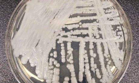 A strain of Candida auris cultured in a petri dish.