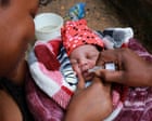 Funding is vital to end the scourge of polio | Letter
