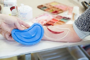 The mould with which the silicone wound is created