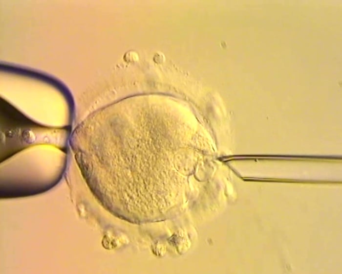 The babies born with DNA from three parents – podcast
