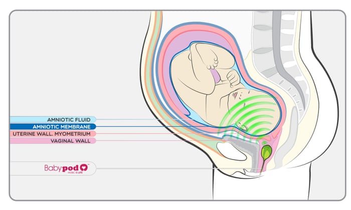 Sonic youth: vaginal speaker lets you play tunes to foetuses Sonic youth: vaginal speaker lets you play tunes to foetuses