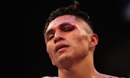 Mauricio Lara’s cut meant his fight with Josh Warrington was stopped and declared a technical draw