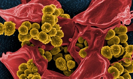 MRSA bacteria under a microscope