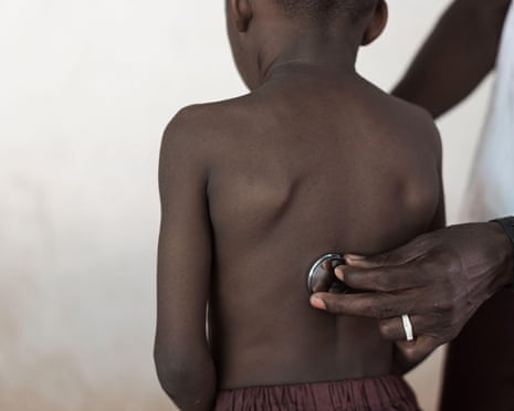 A doctor places a stethoscope on the back of a small boy