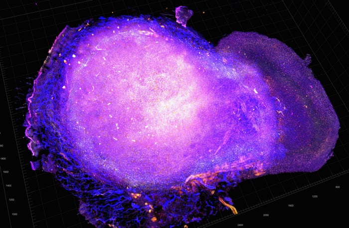 A Cure For Cancer How To Kill A Killer Science The Guardian