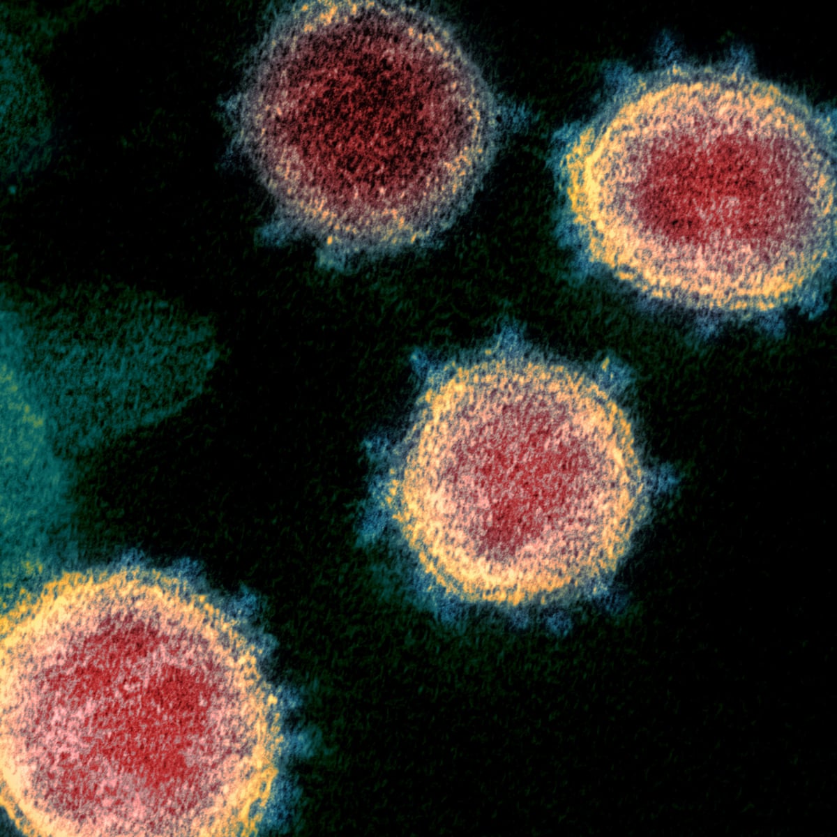 Scientists ask: could summer heat help beat Covid-19? | Coronavirus | The Guardian Scientists ask: could summer heat help beat Covid-19? | Coronavirus | The Guardian