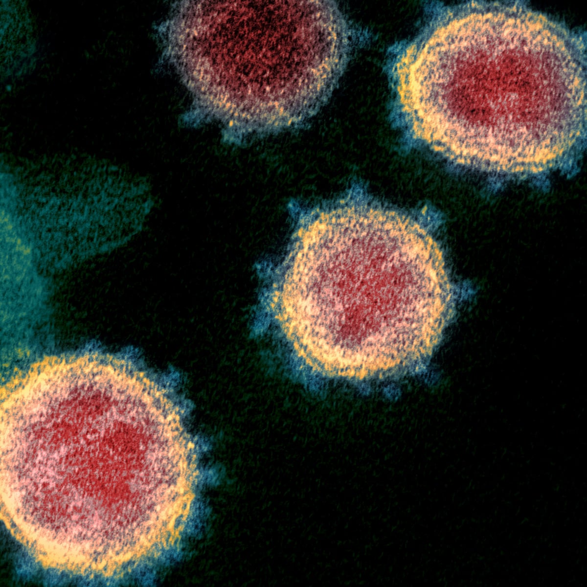 Rashes Headaches Tingling The Less Common Coronavirus Symptoms That Patients Have World News The Guardian