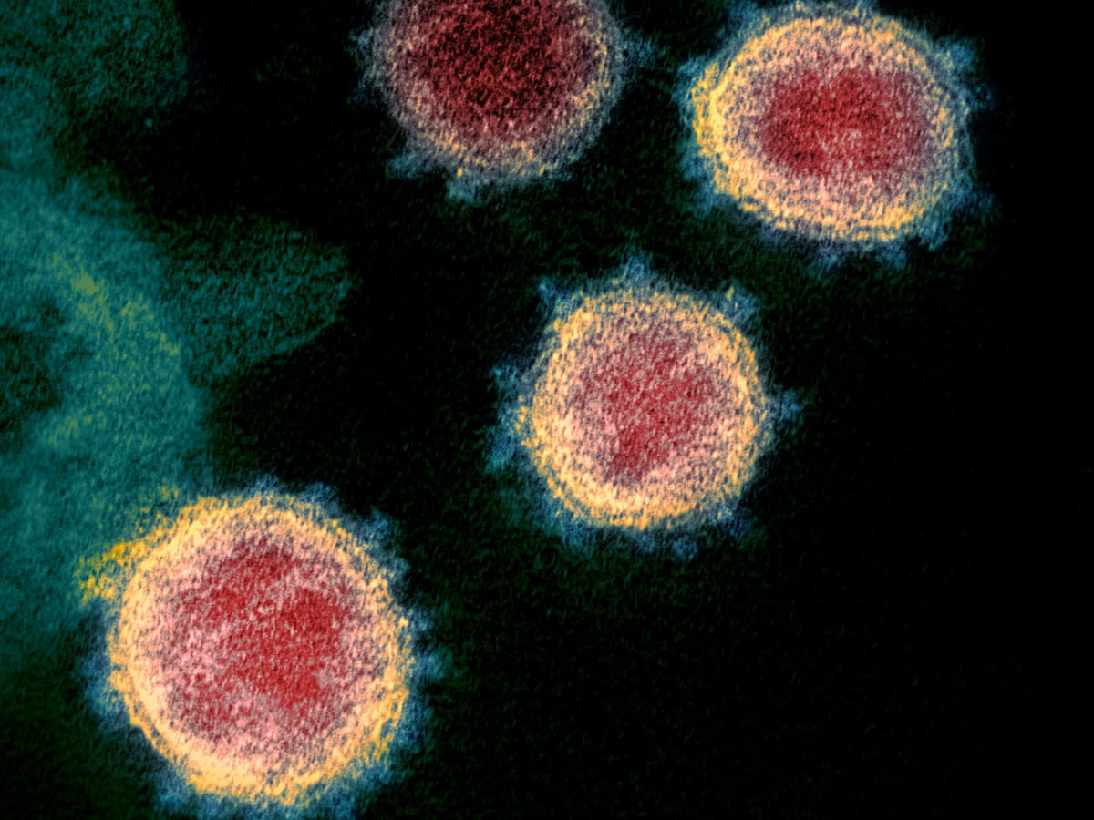 Rashes Headaches Tingling The Less Common Coronavirus Symptoms That Patients Have Coronavirus The Guardian Rashes Headaches Tingling The Less Common Coronavirus Symptoms That Patients Have Coronavirus The Guardian