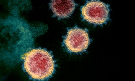 A microscope image shows Covid-19 virus particles emerging from the surface of cells cultured in the lab. 