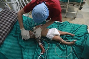 A wounded baby receives medical treatment at a field hospital after regime airstrikes on a residential area in the al-Haydari neighbourhood