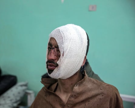An injured man with a bandage wrapped around his head receives treatment in a hospital.