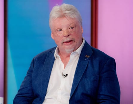 Simon Weston, whose face was scarred in the conflict, speaks on a panel show.